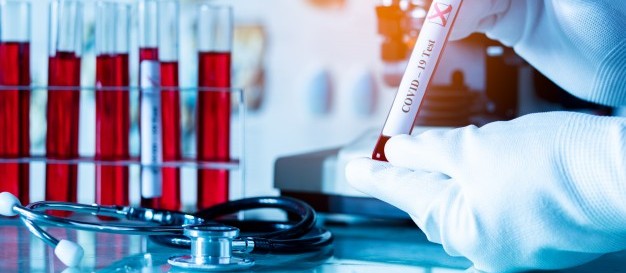 Covid-19: Maringá confirma 19 novos casos no boletim desta segunda-feira