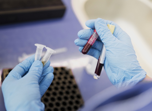 Coronavírus em Maringá: Boletim indica 2 óbitos e 306 casos nesta quinta-feira