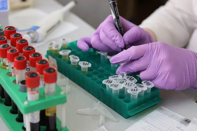 Coronavírus em Maringá: Boletim aponta mais 27 casos e nenhum óbito nesta segunda-feira