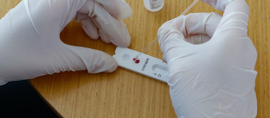 Confira os dados da Covid-19 deste sábado, em Maringá.