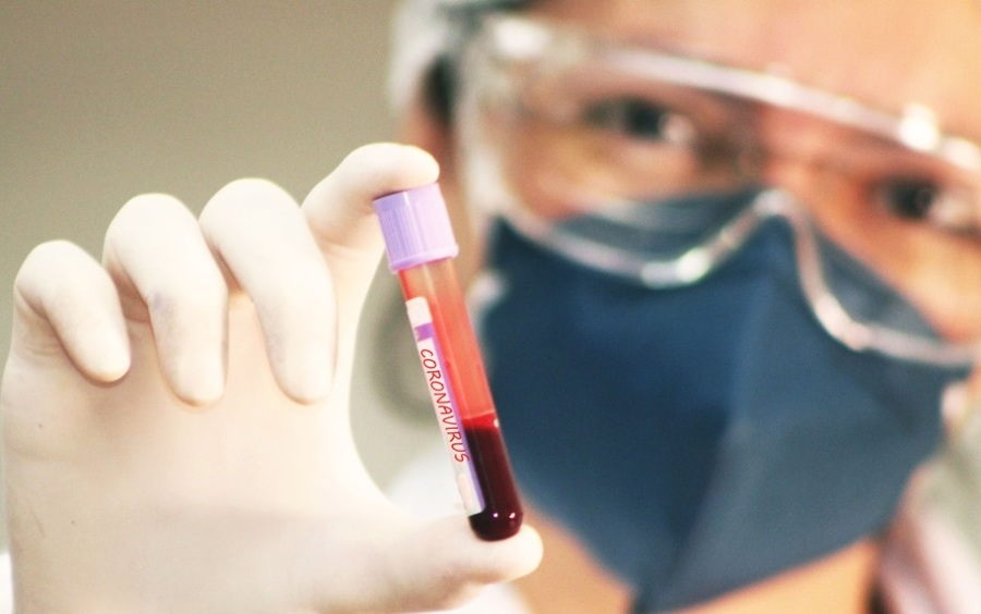 Veja os dados da Covid-19 deste domingo, em Maringá.