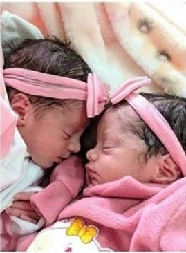 Gêmeas de 26 dias morrem após serem atacadas por cão da família