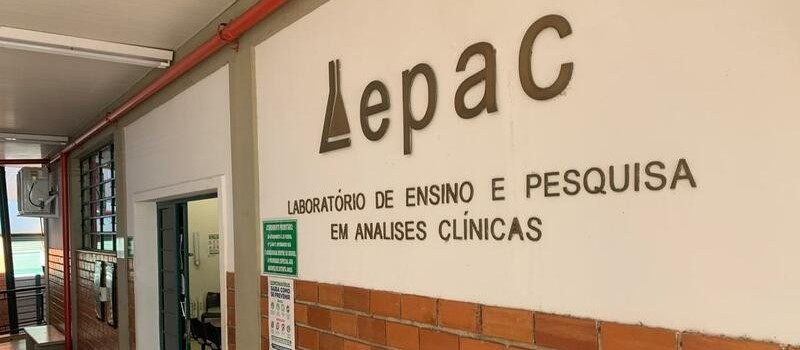 Lepac começa a realizar primeiros exames de Covid-19 nesta sexta.