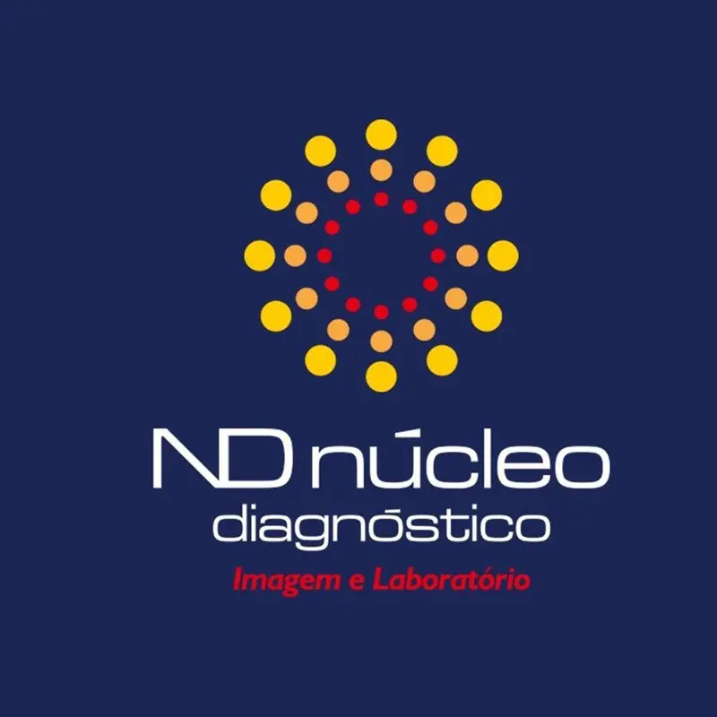Laboratório ND Núcleo Diagnóstico realiza teste de covid-19 em empresas