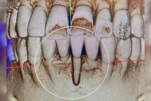 image-63-3