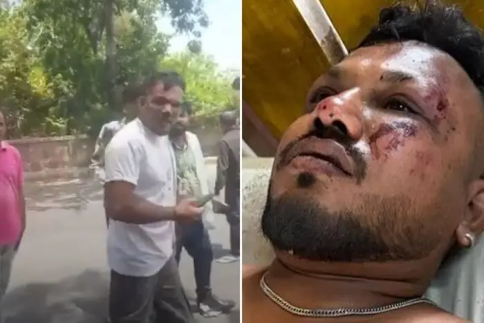 Vishwash Kumar Ramesh, de 40 anos, é sobrevivente de acidente com avião que caiu na Índia. Foto: Reprodução