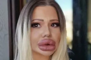 Capturar