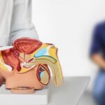 Novembro-Artigo-1-Cirurgia-a-laser-para-o-câncer-de-próstata-1024×569