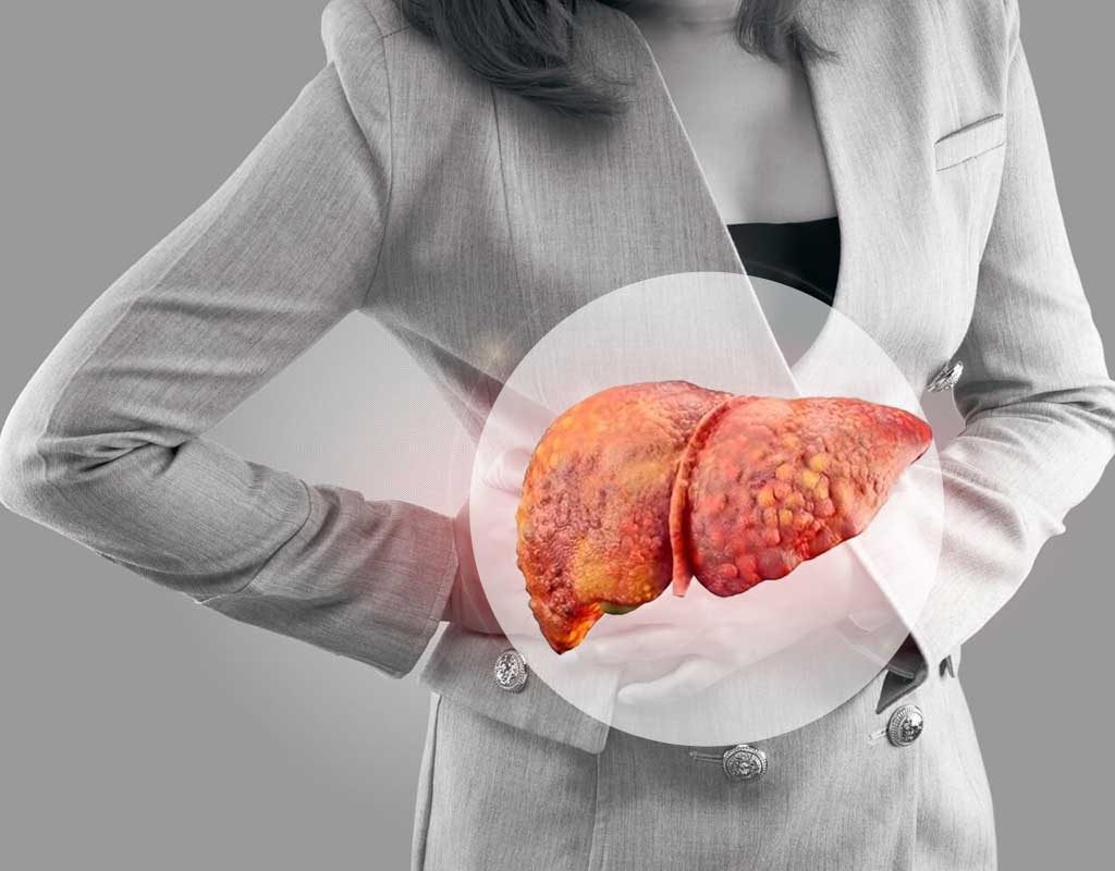 gordura-no-figado-tratamento-rdhkfdnkc83ruvgf9nnpb2dverqlxul1rp8anwq6gw