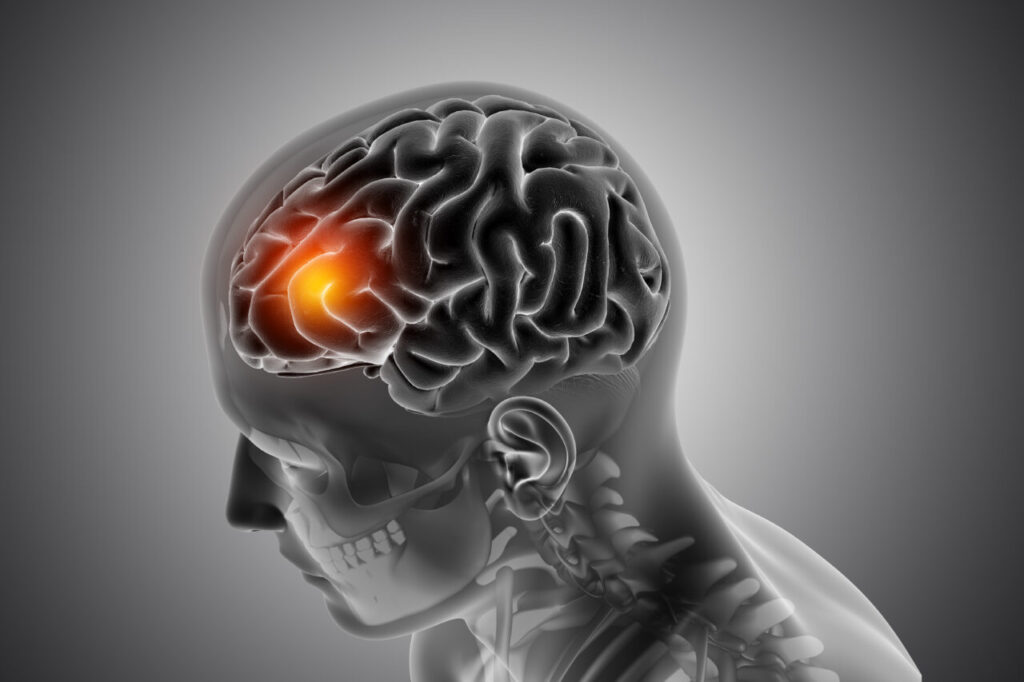 3D male medical figure with front of the brain highlighted