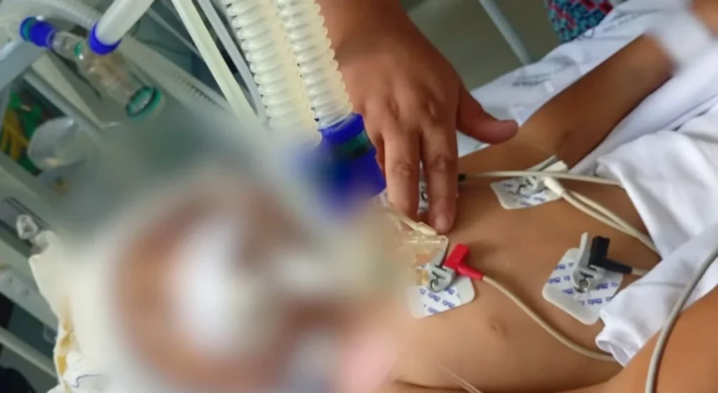 crianca-baleada-bocaiuva