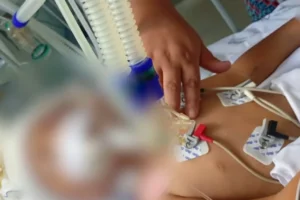 crianca-baleada-bocaiuva