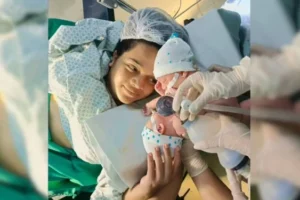 gemeos-siameses-morrem-apos-cirurgia-de-separacao-em-goiania-3087623-article