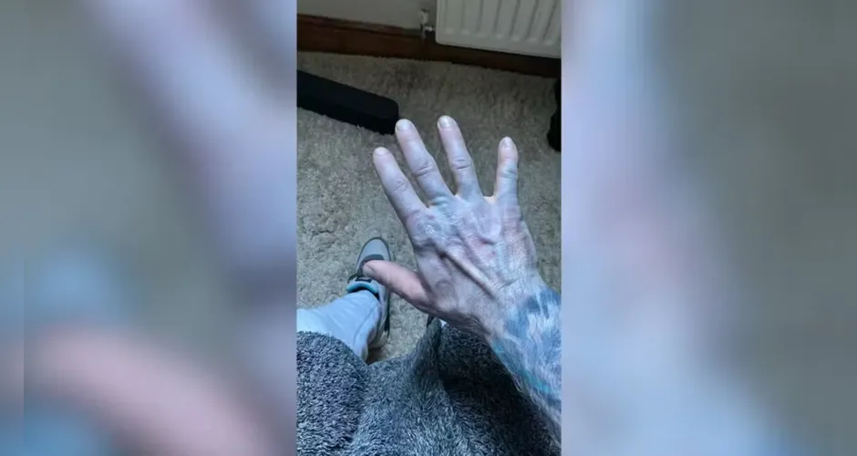 homem-se-assusta-ao-acordar-com-pele-azulada-e-dia-01072075-0-202603121036-3