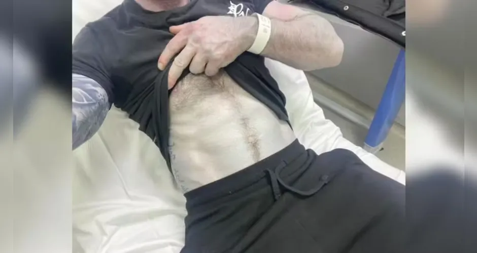 homem-se-assusta-ao-acordar-com-pele-azulada-e-dia-01072075-1-202603121036-3