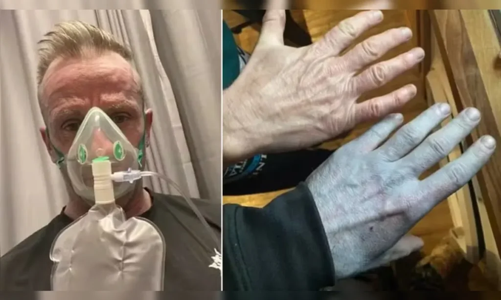 o-britanico-tommy-linch-de-42-anos-01072075-0-202603121036-ProportionalFillBackground