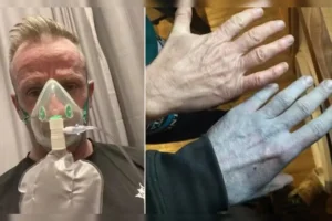 o-britanico-tommy-linch-de-42-anos-01072075-0-202603121036-ProportionalFillBackground