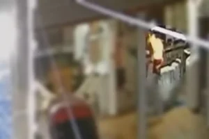 “Tenho medo que ele termine o que começou”, diz mulher que teve 30% do corpo queimado pelo marido 