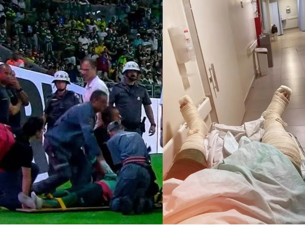 Morador da região socorrido no gramado durante Palmeiras x Santos revela motivo da invasão e pede desculpas