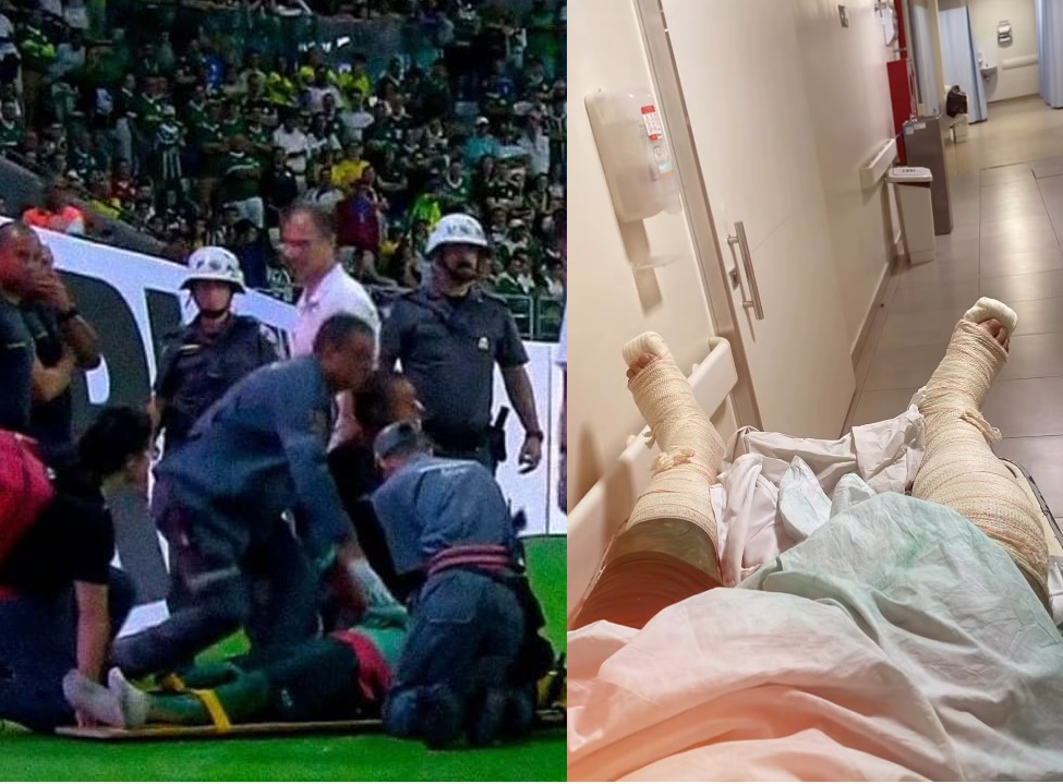 Morador da região invade jogo entre Palmeiras e Santos, se machuca e vai parar no hospital: 'cirurgia de urgência'